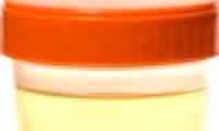 It is easy to isolate stem cells in the urine