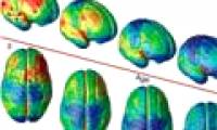 It took 25 years for the brain to develop completely