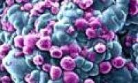 Italian scientists found metastasis in breast cancer