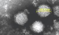 Japan confirms the first case of thrombocytopenic fever transmitted from person to person