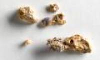 Kidney stones are not frozen but continuously dissolve and develop
