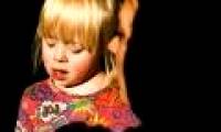 Learn Down syndrome and the truth you should know