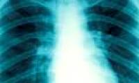 Learn the mechanism of self-regenerating bone right in the body