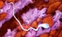 Learn the process of conception in humans through images
