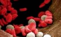 Leukemia is caused by genes