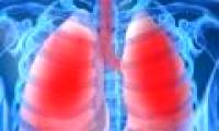 Major threat of chronic obstructive pulmonary disease
