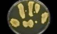 Mapping 3,000 dangerous bacteria genes
