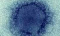 MERS virus has been transmitted from animals to humans