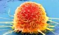Miracle diet: Starve cancer tumors like soldiers