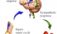 Mysterious syndrome causes more pain than labor