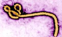New discovery about the virus that causes 25-90% of infected people to die
