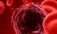 New discovery of genes related to blood cancer
