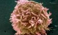 New discovery of metastatic mechanism of cancer cells