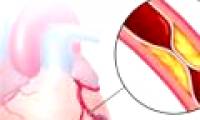 New hope for patients with heart attack