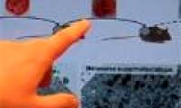 New ideas can eliminate cancer cell's metastasis