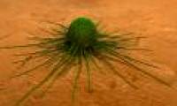 New injection for cancer treatment