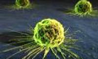 New mathematical model against cancer