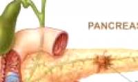 New method of early diagnosis of pancreatic cancer