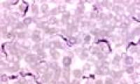 New technique to help learn about African sleeping sickness