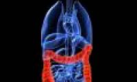 New test to detect colon cancer