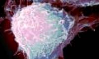 New treatment for prostate cancer