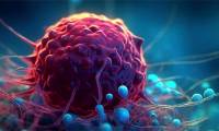 New way found to kill the world's second most common cancer