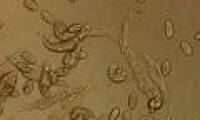 No sexual reproduction but still gene exchange