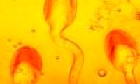 Normal indicators when evaluating a semen test