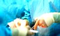 Nurse replacement syringe