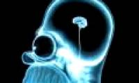 Obese people are more likely to get cancer when taking X-rays