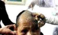 One more woman grows horns in China
