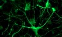 Our brains tend to predict the future, do you realize that?