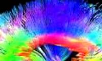 Painters have a different brain structure than ordinary people