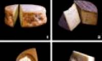 Patients with breast cancer and full-fat dairy products