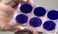 Polio virus offers hope for curing brain cancer