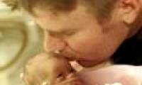 Premature babies weigh 720g