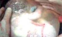 Rare picture of babies born in amniotic sac