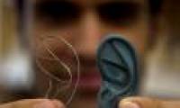 Reconstructing ears from patient cells