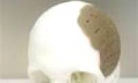 Recreate parts of the body with 3D printing technology