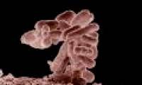 'Redesign of E. coli bacteria to prevent green pus bacilli