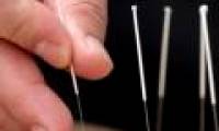 Reduce eczema with tea and acupuncture