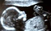 Research found vitamin B3 helps reduce miscarriage, birth defects