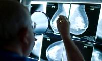 Researchers have found a chance to block breast cancer