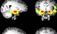 Revealing the secret of a spoiled teenage brain