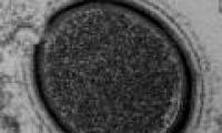 Revived ancient virus 30,000 years old