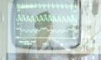 Russian science makes smart heart rate counters