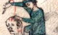 Scary healing ways in the Middle Ages