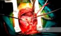 Scientists found a completely new type of cell, helping to heal damage in the heart