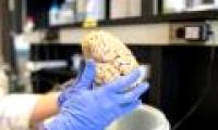 Scientists have found a way to completely prevent brain cancer