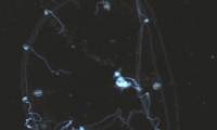 Scientists have just discovered a way to read the mind of jellyfish, which have no brains